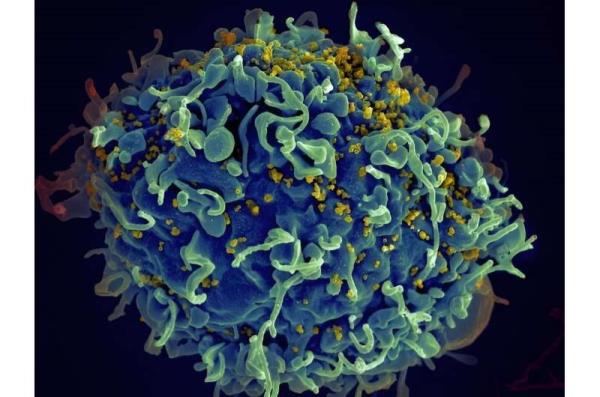 研究发现瑞典HIV-1亚型分布的变化