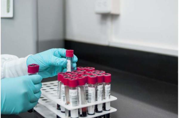 中风检测的新血液测试结合了基于血液的生物标志物和临床评分